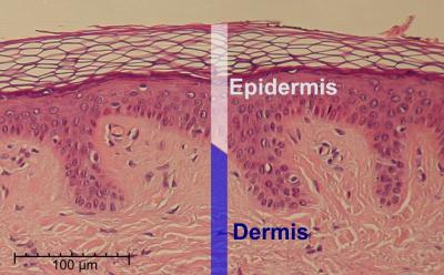 Epidermis Delimited 1 